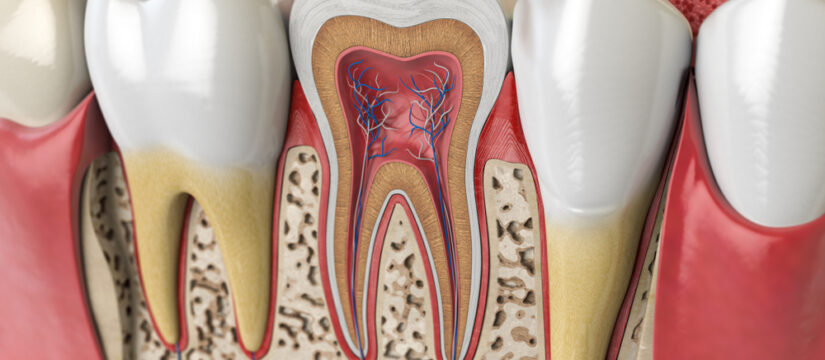 root canal